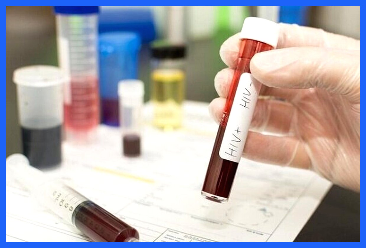 کاهش شیوع HIV در میان معتادان تزریق‌کننده موادمخدر