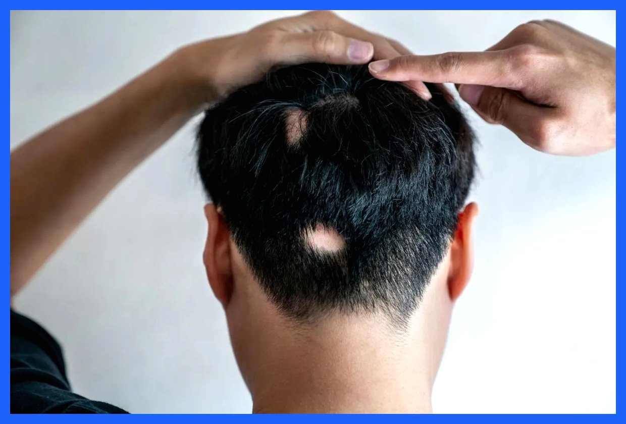 آیا نگران کچل شدن هستید؟ از این هوش مصنوعی راهنمایی بگیرید!