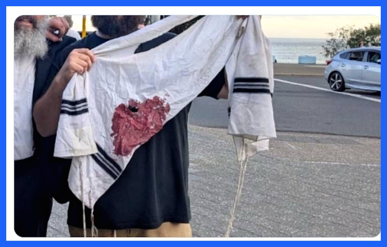 واکنش‌های جهانی به حادثه استرالیا؛ از استارمر تا رئیس کمیسیون اروپا