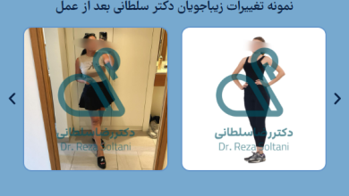 نتایج عمل لیپوماتیک چطور و چه زمان قابل مشاهده است؟