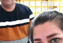 عملية تجميل في ايران مع نورا