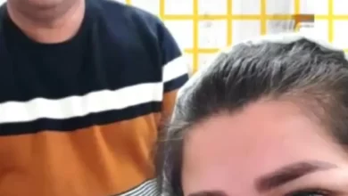 عملية تجميل في ايران مع نورا