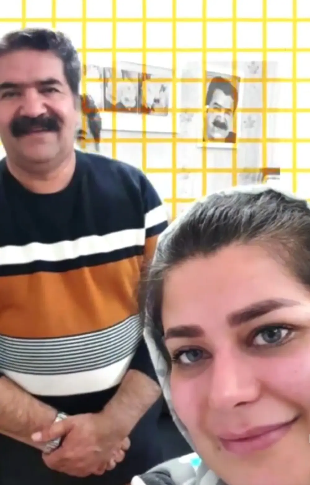 عملية تجميل في ايران مع نورا