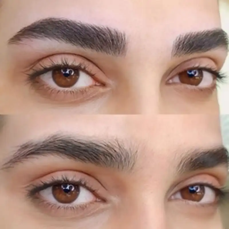 نمونه میکروبلیدینگ کرج