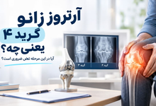 آرتروز زانو گرید 4 یعنی چه