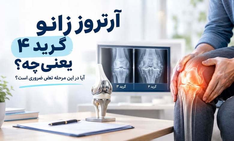 آرتروز زانو گرید 4 یعنی چه