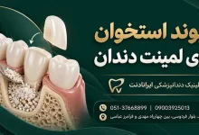 تصویر پیوند استخوان فک برای درمان دندان با معرفی کلینیک دندانپزشکی ایرانادنت مشهد