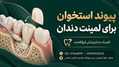 تصویر پیوند استخوان فک برای درمان دندان با معرفی کلینیک دندانپزشکی ایرانادنت مشهد