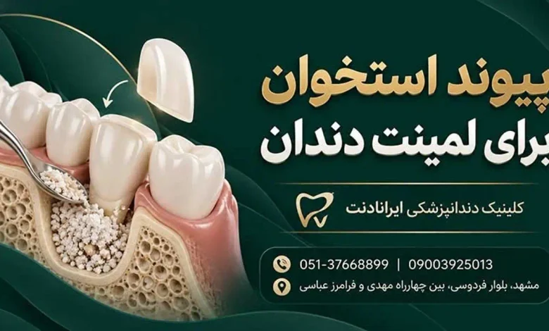 تصویر پیوند استخوان فک برای درمان دندان با معرفی کلینیک دندانپزشکی ایرانادنت مشهد
