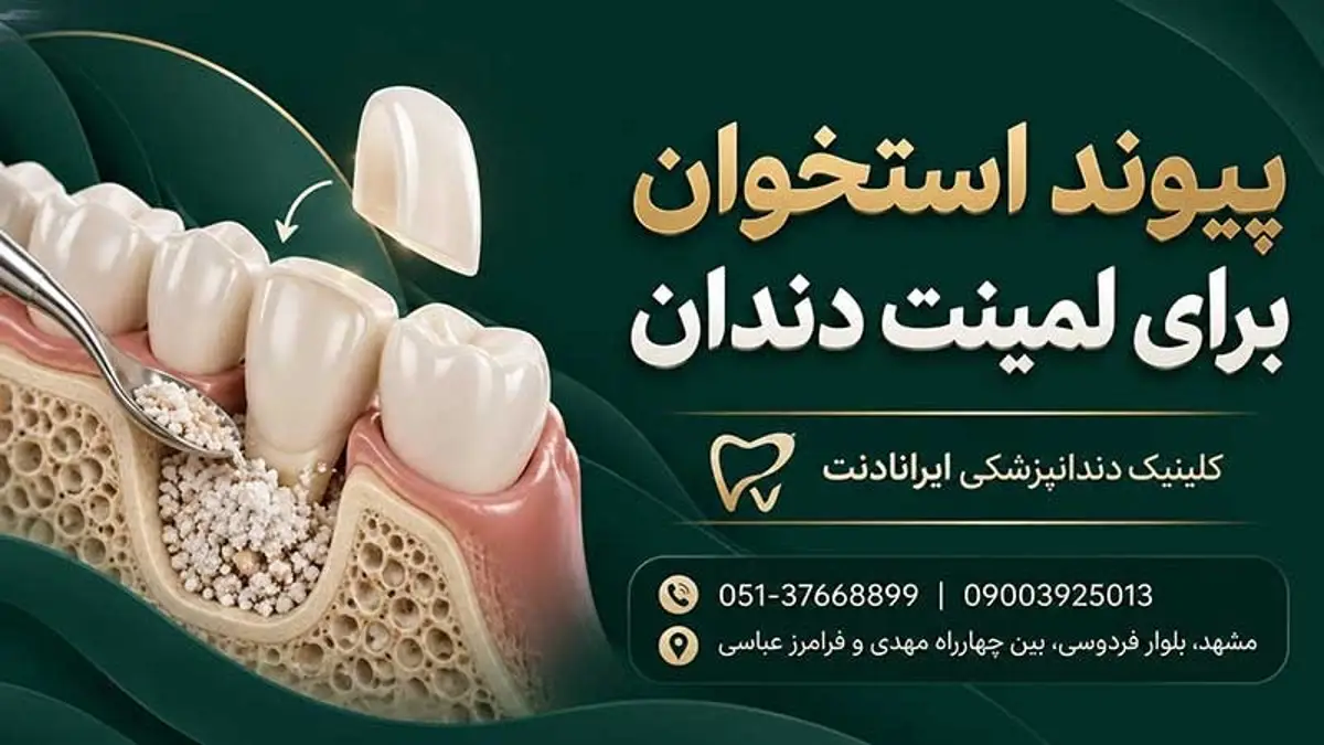 تصویر پیوند استخوان فک برای درمان دندان با معرفی کلینیک دندانپزشکی ایرانادنت مشهد
